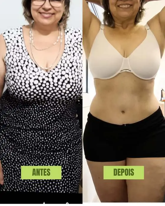 Antes e depois de aluna do metodo Lud Carnevale
